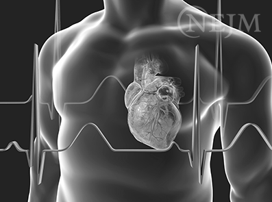 Post stroke therapy and prevention